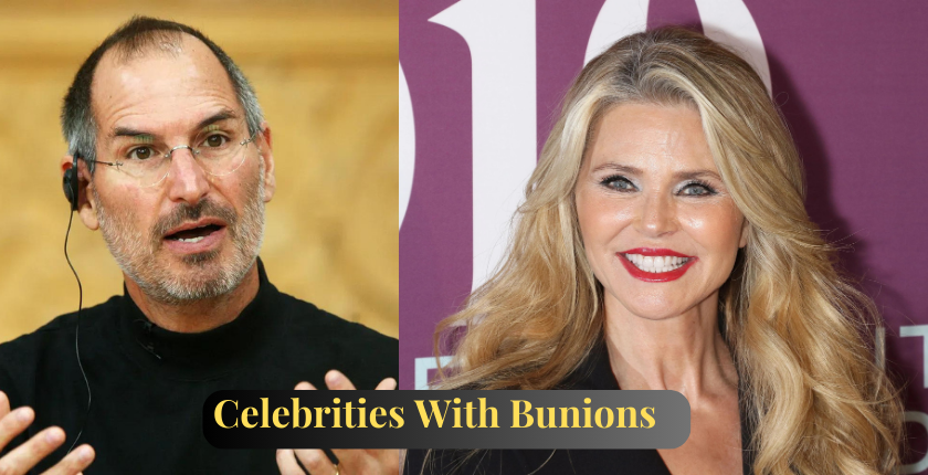 Celebrities With Bunions