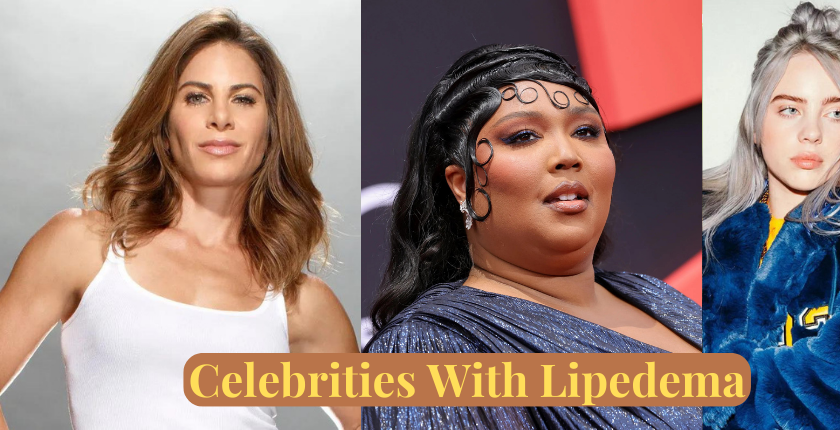 10 Celebrities With Lipedema – Their Stories and Struggles