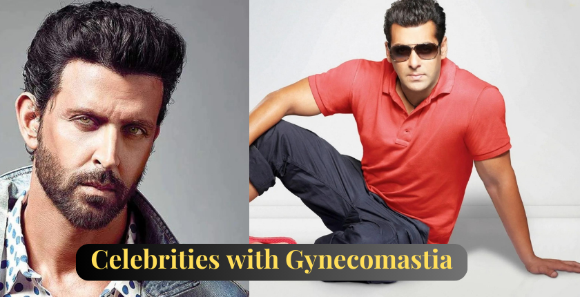 13 Celebrities with Gynecomastia – Their Inspiring Stories and Treatment Options