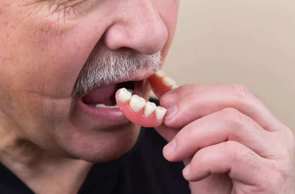 Senior inserting hybrid dentures for comfort.