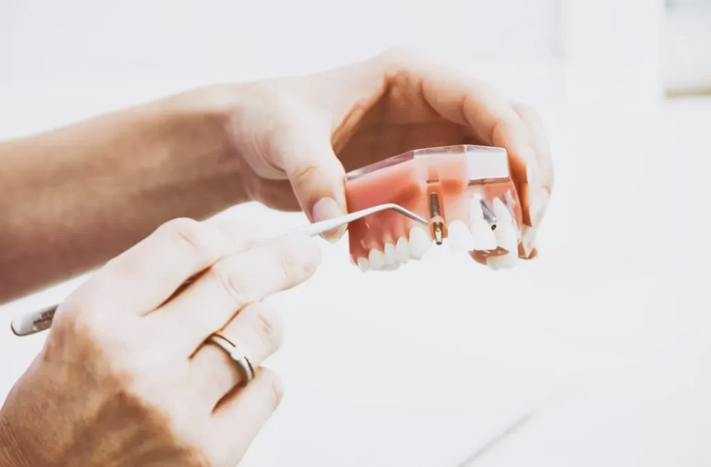 Dental implant model being demonstrated using tools.