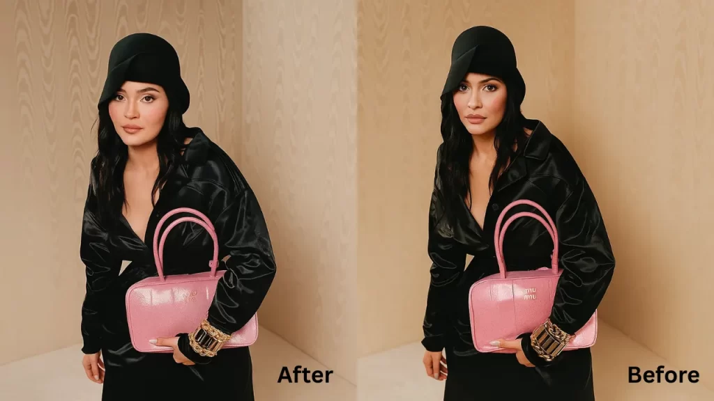 celebrity blepharoplasty before and after